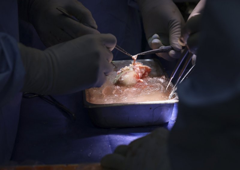 Dva mjeseca od transplantacije umro čovjek koji je dobio svinjski bubreg