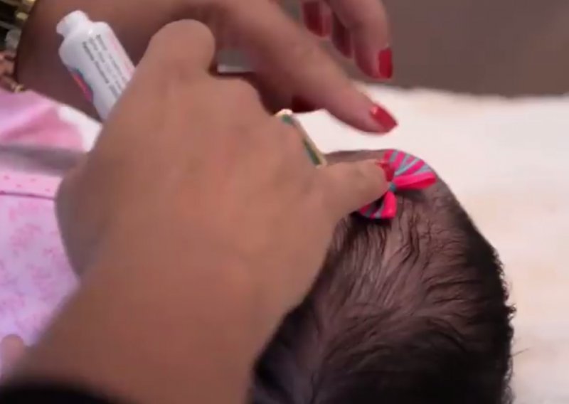 Dilemu 'curica ili dečko' rješavaju ljepilom za bebinu glavu